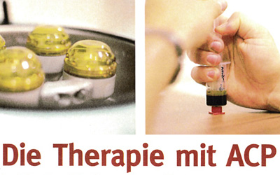 ACP Therapie